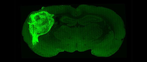 Human ‘mini-brains’ implanted in rats prompt excitement — and concern