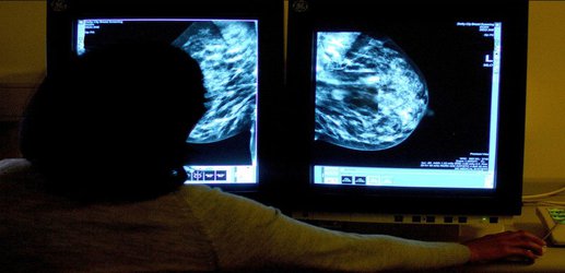 Inquiry launched into 450,000 missed breast cancer screenings