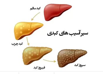 کارشناس واحد تغذیه شبکه بهداشت و درمان شهرستان عسلویه؛
کبد چرب شایع‌ترین بیماری کبدی است