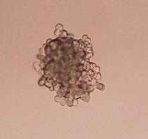 کاهش میزانِ دُز پرتودرمانی در سلول‌های سرطانی با استفاده از بوتئین