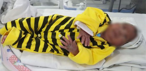 ترخیص نوزاد ۱۲۶۰ گرمی از بخش مراقبت های ویژه نوزادان مرکز درمانی حکیم