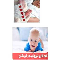 پیشگیری از عقب ماندگی ذهنی ۸۹۲ نوزاد در کرمانشاه با غربالگری کم کاری تیروئید مادرزادی