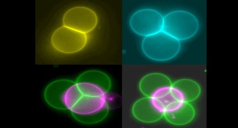 Mini tractor beams help arrange artificial cells into tissue structures