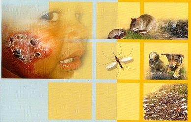 تولید فرآورده نانویی برای درمان بیماری سالک توسط محققان علوم پزشکی مشهد