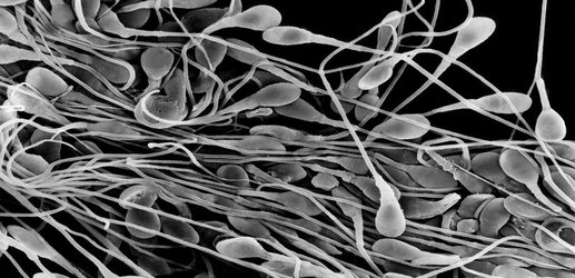 Changes in your sperm reveal if you’ve had a difficult life
