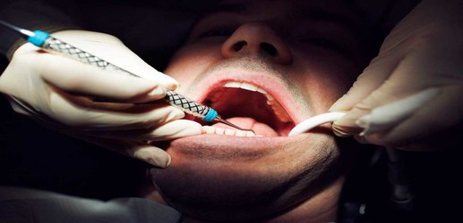 Dentists can smell your fear – and it may put your teeth at risk