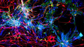 Trio of genes supercharged human brain evolution