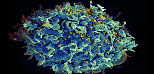 We’re beginning to understand how some people can control HIV