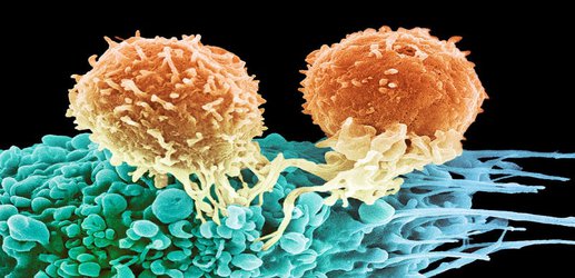 Woman survives metastatic breast cancer thanks to new treatment