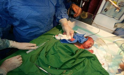 انجام اولین picc در بخش نوزادان مرکز آموزشی درمانی فاطمیه