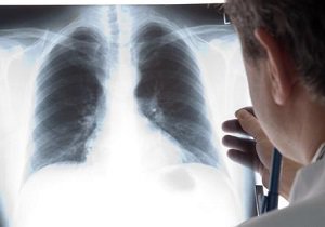 در دانشگاه امیرکبیر محقق شد: تولید آزمایشگاهی نانوالیاف مغناطیسی با قابلیت رهایش هدفمند داروی سرطان