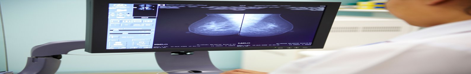 Breast screening based on women’s risk level would reduce overdiagnosis