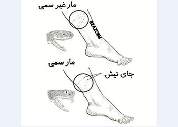 چگونه انواع مارها را بشناسیم و از گزش‌های احتمالی پیشگیری کنیم