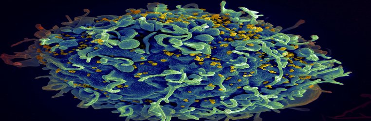 Zero HIV transmissions in gay men not using condoms on HIV treatment