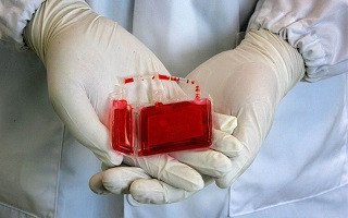 چهارمین فراخوان حمایت از طرح های پژوهشی بانک خون بندناف رویان
  