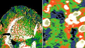 Powerful beams of infrared light could probe cells, diagnose diseases