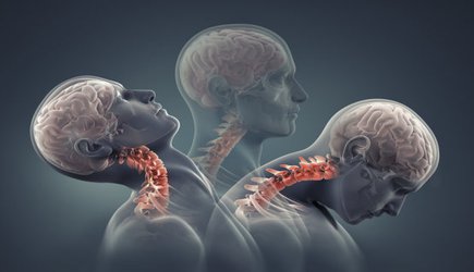 Head and neck positioning affects concussion risk