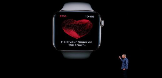 New Apple Watch heart monitor sounds great – here’s why it may not be