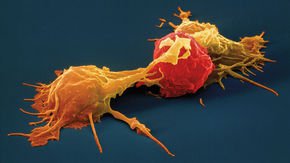 Engineered natural killer cells may be the next great cancer immunotherapy