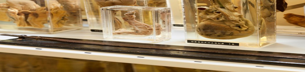 Dead Good: Rare opportunity to visit UCL Pathology Museum