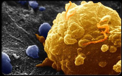 طراحی کمپلکس نانو دارو برای توقف رشد سلول های سرطانی توسط پژوهشگران کشور