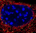 Mitochondrial diseases could be treated with gene therapy, study suggests