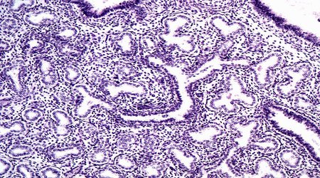 Trump administration launches sweeping review of fetal-tissue research