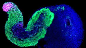 Mouse stem cells can self-organize into headless ‘little bananas’