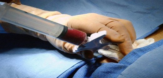 آندوسکوپی موجب انتقال ایدز می شود؟/ سل؛ جزو ۱۰ علت اول مرگ و میر جهان