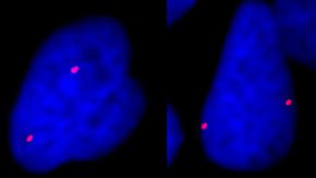 Moving DNA to a different part of the nucleus can change how it works