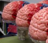 Cambridge team develops technique to ‘listen’ to a patient’s brain during tumour surgery