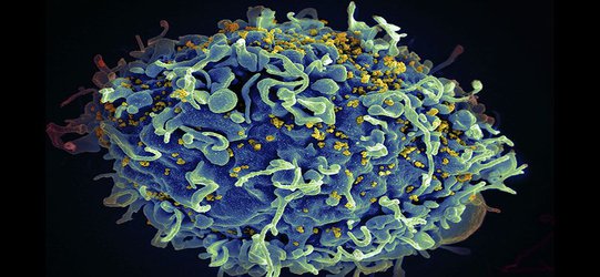 Virus detectives test whole-body scans in search of HIV's hiding places