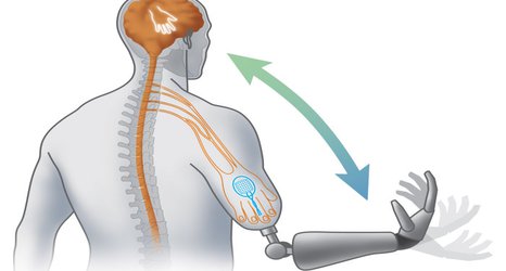 Bionic limbs to get sense of touch thanks to €10m grant to breakthrough project