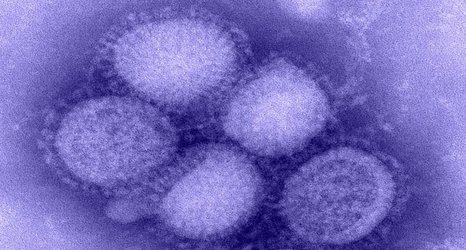 Flu virus could evolve resistance to pandemic drug