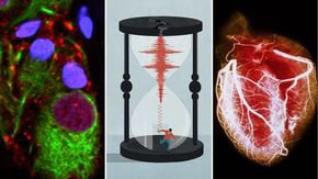 Top stories: the appendix’s secret seeds, earthquake warnings, and a halted heart repair trial