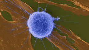 In a paradox, obesity is a ‘net positive’ for cutting-edge anticancer drugs