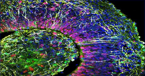 Lab-grown ‘mini brains’ produce electrical patterns that resemble those of premature babies