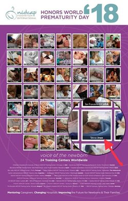 بیمارستان ۲۲ آبان لاهیجان در لیست جهانی مراکز حامی نوزاد نارس قرار گرفت