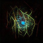 World’s Deepest-Penetration and Fastest Optical Cameras