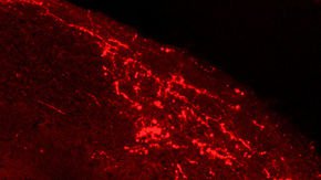 Newly discovered pain pathway may help explain why animal tests fail to reveal the best painkillers