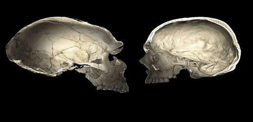Some people have slightly squashed heads thanks to Neanderthal DNA