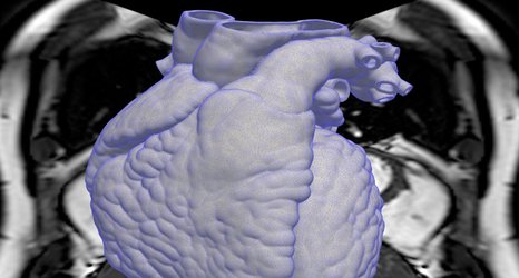 Imperial and Bayer to accelerate drug discovery for heart conditions using AI