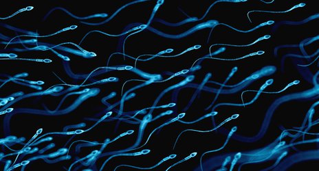 Recurrent miscarriage linked to faulty sperm 