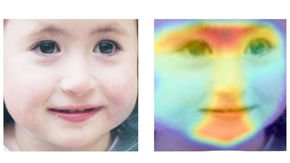 Artificial intelligence could diagnose rare disorders using just a photo of a face