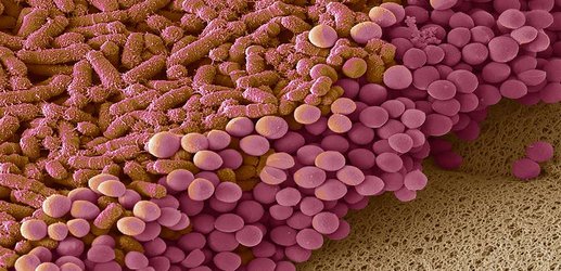 People with depression are less likely to have certain gut bacteria