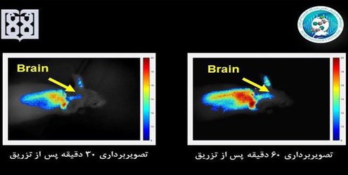 در دانشگاه علوم پزشکی تهران محقق شد: ردیابی مسیر دارورسانی به مغز با تصویربرداری اپتیکی