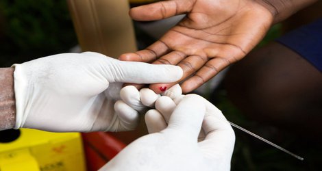 ‘Test and Treat’ reduces new HIV infections by a third in African communities 