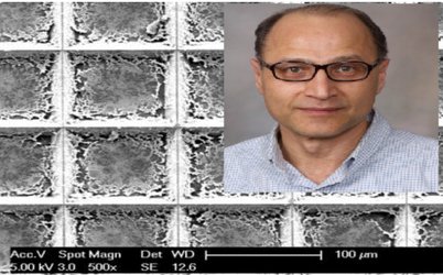 شناسایی سریعتر و دقیقتر تومورهای سرطانی با تراشه ابداعی دانشمند ایرانی